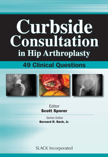 Curbside Consultation in Hip Arthroplasty : 49 Clinical Questions, PDF eBook