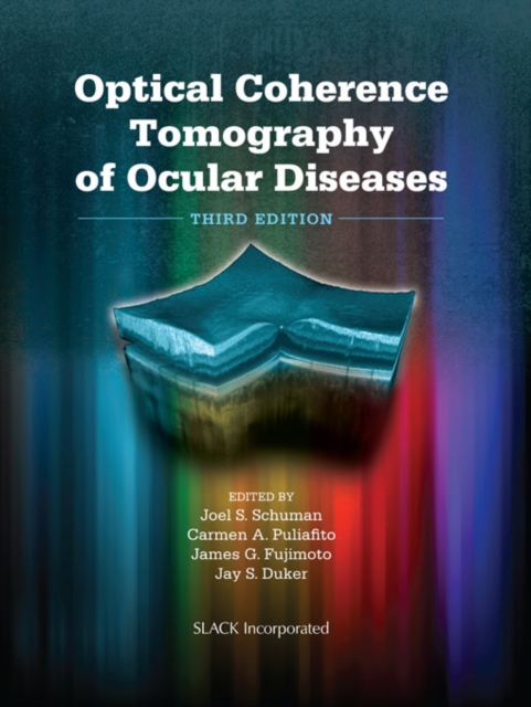 Optical Coherence Tomography of Ocular Diseases : Third Edition, PDF eBook