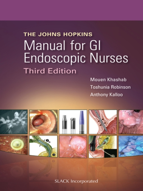 Johns Hopkins Manual for GI Endoscopic Nurses Third Edition, PDF eBook