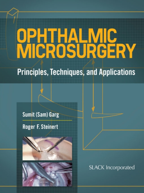 Ophthalmic Microsurgery : Principles, Techniques, and Applications, PDF eBook