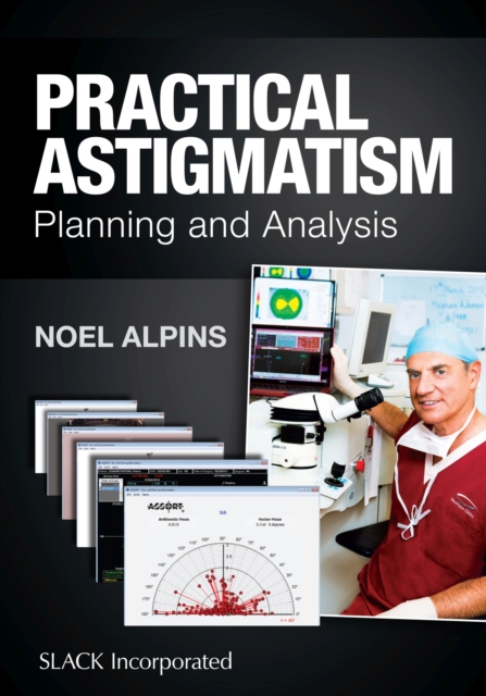 Practical Astigmatism : Planning and Analysis, Hardback Book