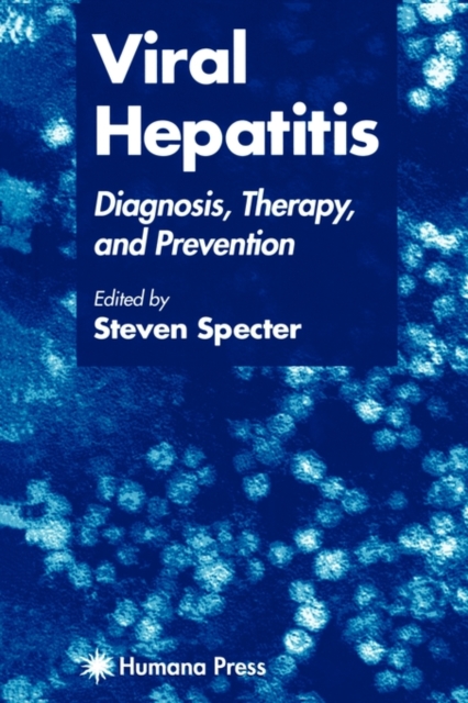 Viral Hepatitis : Diagnosis, Therapy, and Prevention, Paperback / softback Book
