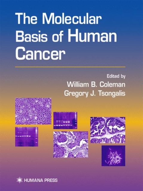 The Molecular Basis of Human Cancer, Paperback / softback Book