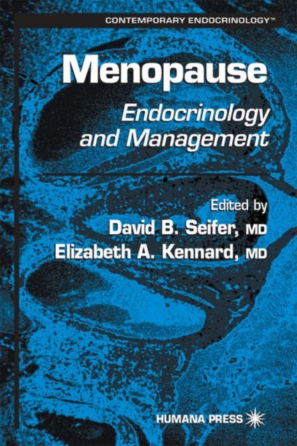 Menopause : Endocrinology and Management, Paperback / softback Book