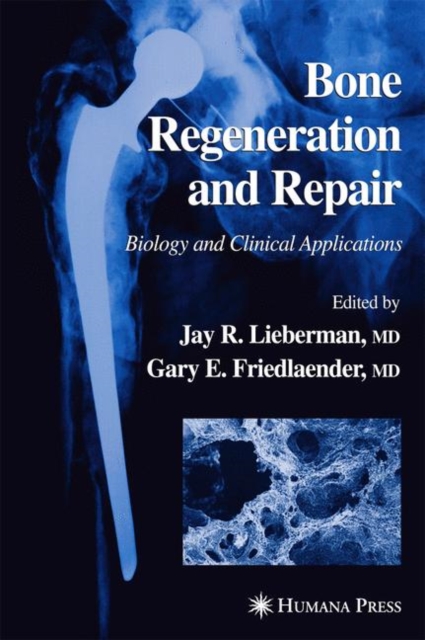 Bone Regeneration and Repair : Biology and Clinical Applications, Paperback / softback Book