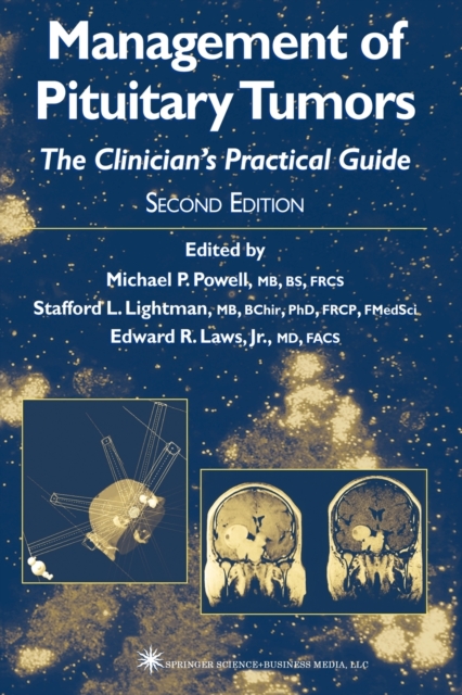 Management of Pituitary Tumors : The Clinician’s Practical Guide, Paperback / softback Book