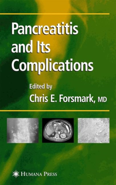 Pancreatitis and Its Complications, Paperback / softback Book
