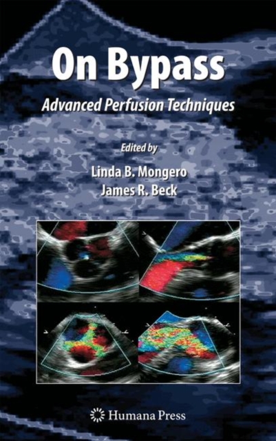 On Bypass : Advanced Perfusion Techniques, Paperback / softback Book