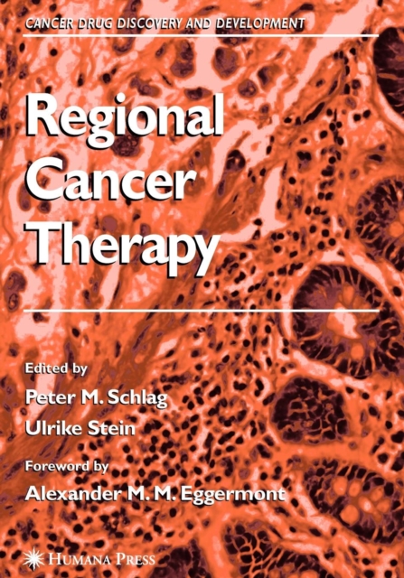 Regional Cancer Therapy, Paperback / softback Book