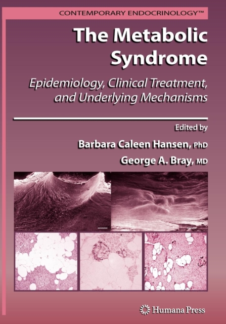 The Metabolic Syndrome: : Epidemiology, Clinical Treatment, and Underlying Mechanisms, Paperback / softback Book