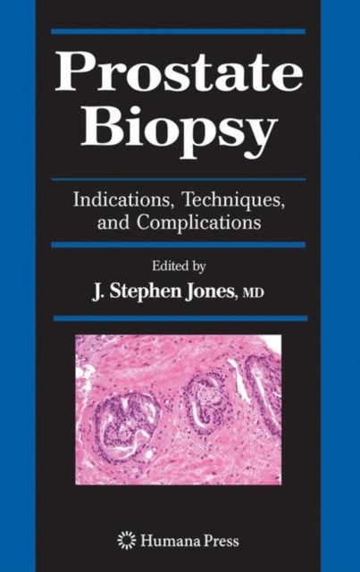 Prostate Biopsy : Indications, Techniques, and Complications, Paperback / softback Book