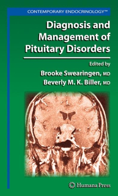 Diagnosis and Management of Pituitary Disorders, Paperback / softback Book