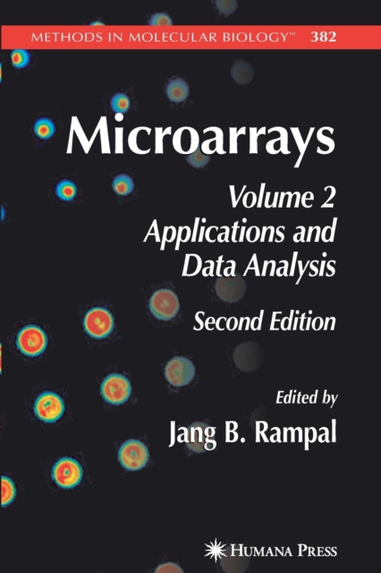 Microarrays : Volume 2, Applications and Data Analysis, Paperback / softback Book