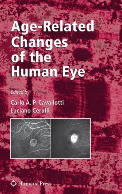Age-Related Changes of the Human Eye, Paperback / softback Book