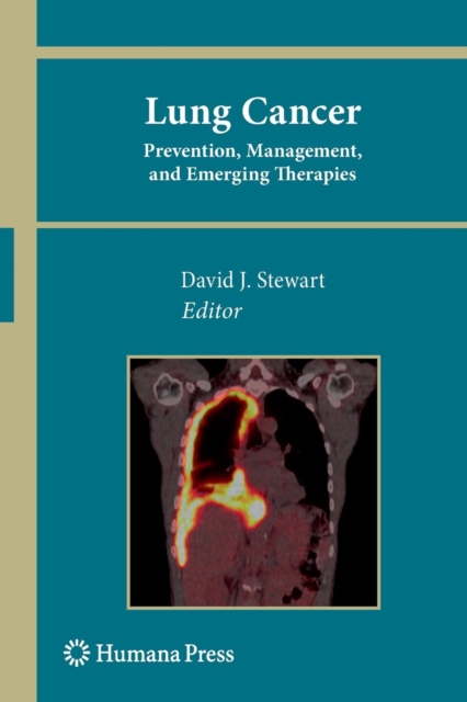 Lung Cancer: : Prevention, Management, and Emerging Therapies, Paperback / softback Book
