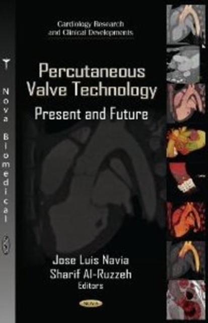 Percutaneous Valve Technology : Present & Future, Hardback Book