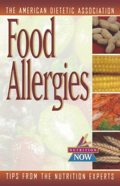 Food Allergies : The Nutrition Now Series, EPUB eBook