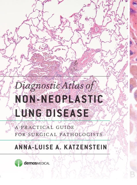 Diagnostic Atlas of Non-Neoplastic Lung Disease : A Practical Guide for Surgical Pathologists, Hardback Book