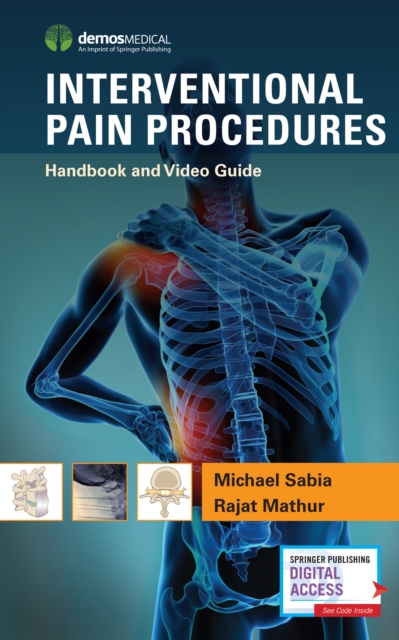 Interventional Pain Procedures : Handbook and Video Guide, Paperback / softback Book