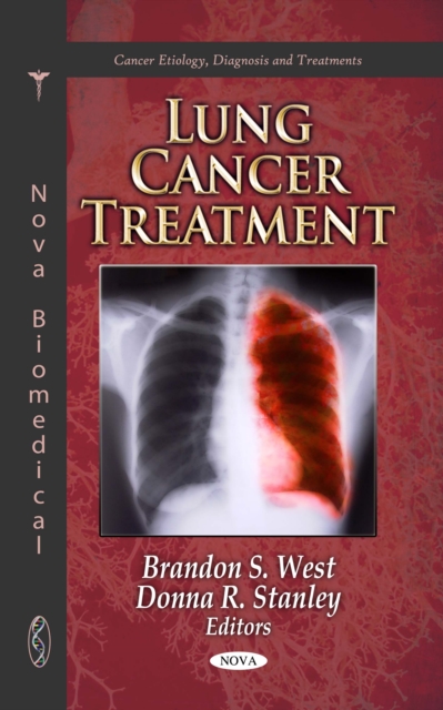 Lung Cancer Treatment, PDF eBook