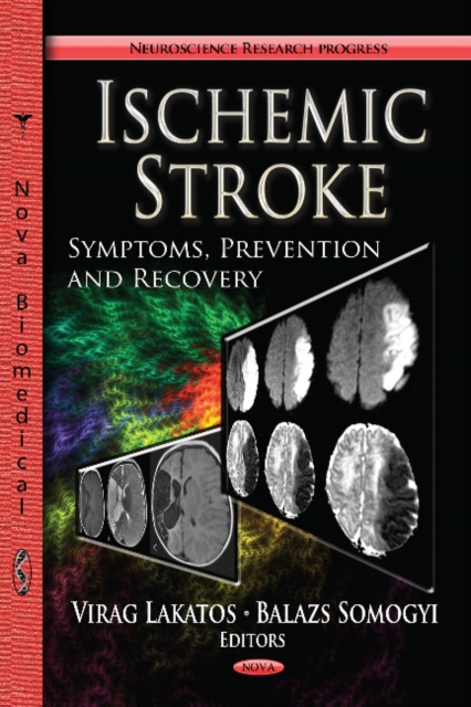 Ischemic Stroke : Symptoms, Prevention & Recovery, Hardback Book