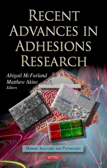 Recent Advances in Adhesions Research, Paperback / softback Book
