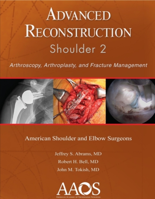Advanced Reconstruction: Shoulder 2 : Arthroscopy, Arthroplasty, and Fracture Management, Paperback / softback Book