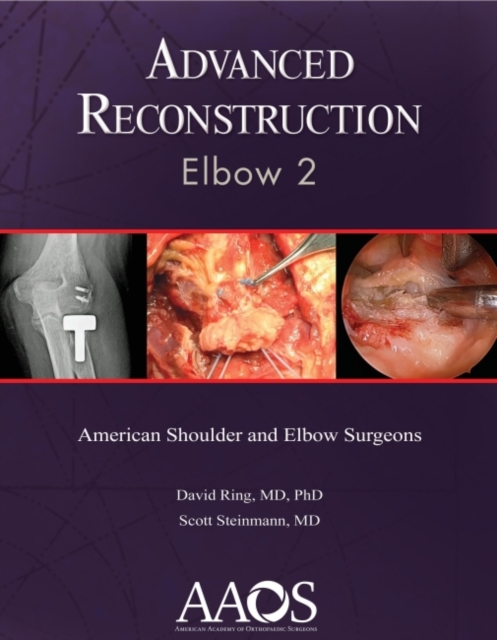 Advanced Reconstruction: Elbow 2, Paperback / softback Book