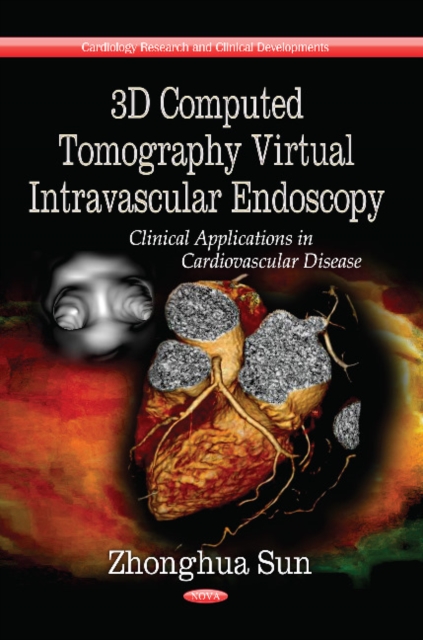 3D Computed Tomography Virtual Intravascular Endoscopy : Clinical Applications in Cardiovascular Disease, Paperback / softback Book