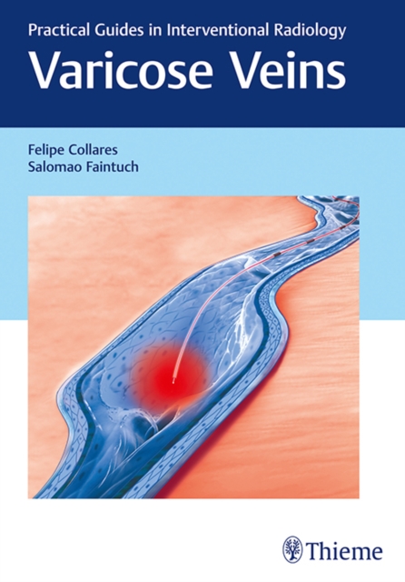 Varicose Veins : Practical Guides in Interventional Radiology, Hardback Book