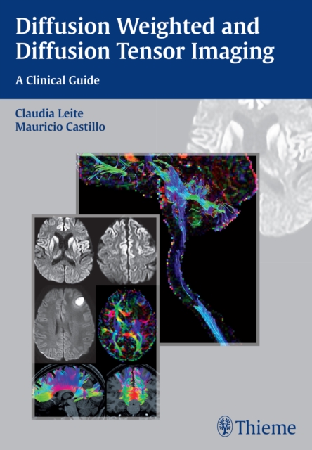 Diffusion Weighted and Diffusion Tensor Imaging : A Clinical Guide, Paperback / softback Book