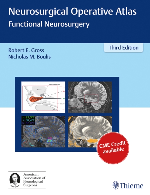 Neurosurgical Operative Atlas : Functional Neurosurgery, Mixed media product Book