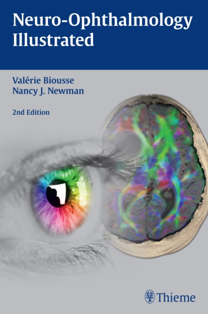 Neuro-Ophthalmology Illustrated, Paperback / softback Book