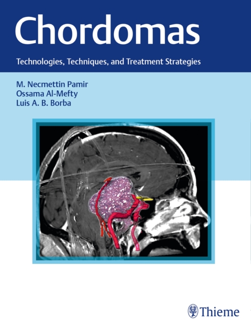 Chordomas : Technologies, Techniques, and Treatment Strategies, Hardback Book