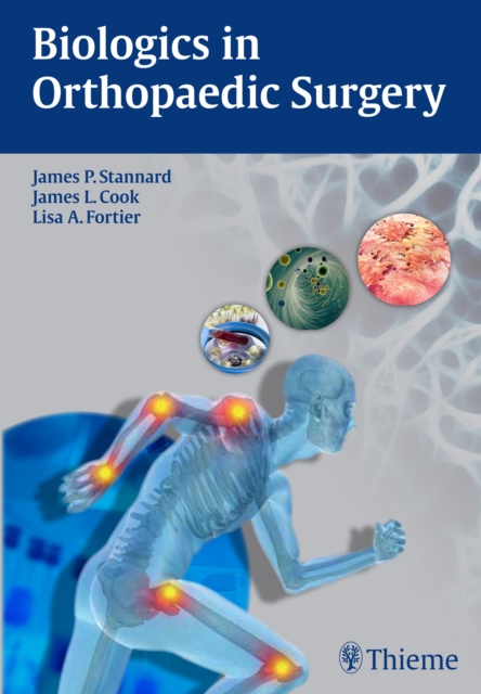 Biologics in Orthopaedic Surgery, Hardback Book