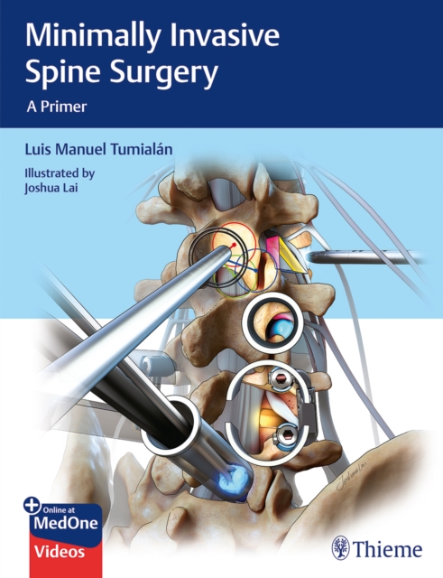Minimally Invasive Spine Surgery : A Primer, Multiple-component retail product, part(s) enclose Book