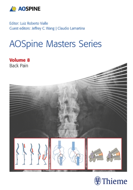 AOSpine Masters Series, Volume 8: Back Pain, Hardback Book