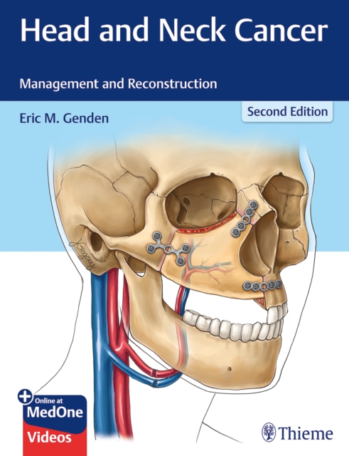 Head and Neck Cancer : Management and Reconstruction, Multiple-component retail product, part(s) enclose Book