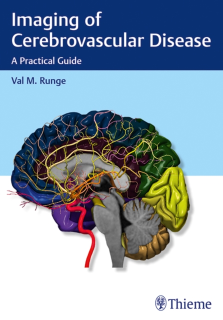 Imaging of Cerebrovascular Disease : A Practical Guide, Paperback / softback Book