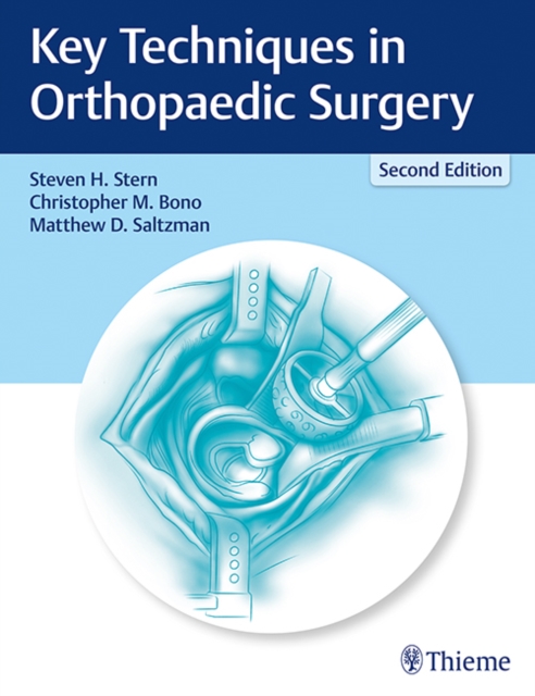Key Techniques in Orthopaedic Surgery, Hardback Book