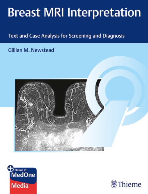 Breast MRI Interpretation : Text and Case Analysis for Screening and Diagnosis, Mixed media product Book