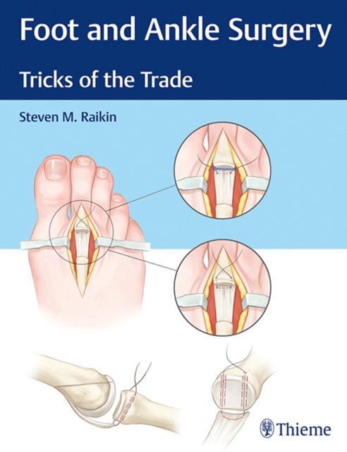 Foot and Ankle Surgery : Tricks of the Trade, Hardback Book