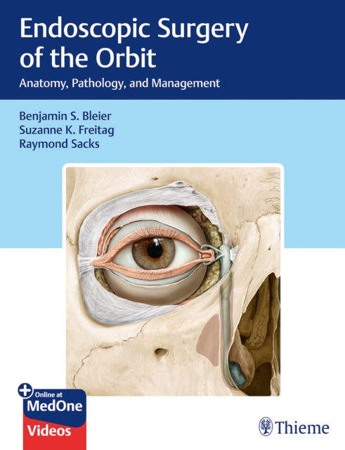 Endoscopic Surgery of the Orbit : Anatomy, Pathology, and Management, Multiple-component retail product, part(s) enclose Book