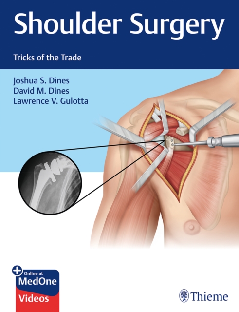 Shoulder Surgery : Tricks of the Trade, Multiple-component retail product, part(s) enclose Book