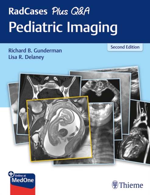RadCases Plus Q&A Pediatric Imaging, Paperback / softback Book