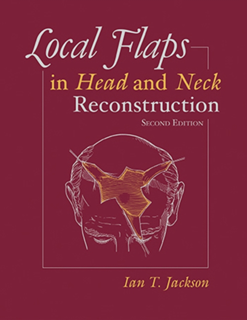 Local Flaps in Head and Neck Reconstruction, Hardback Book
