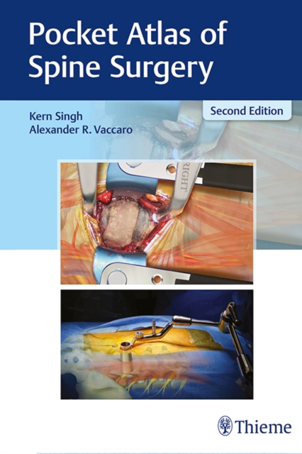 Pocket Atlas of Spine Surgery, Paperback / softback Book
