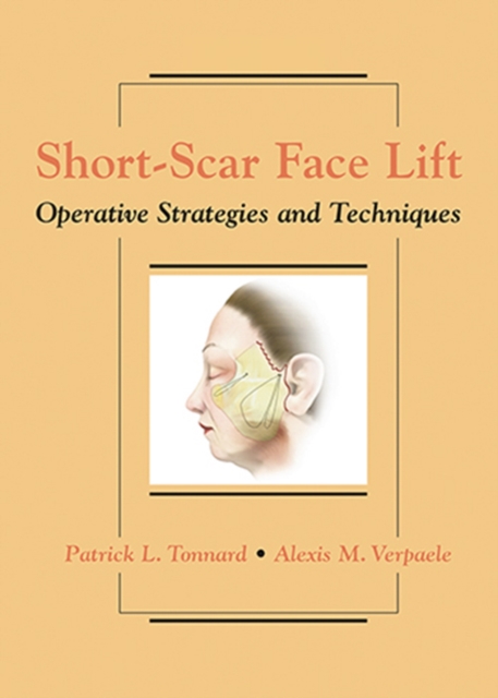 Short-Scar Face Lift : Operative Strategies and Techniques, Hardback Book