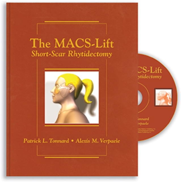 The MACS-Lift : Short-Scar Rhytidectomy, Hardback Book