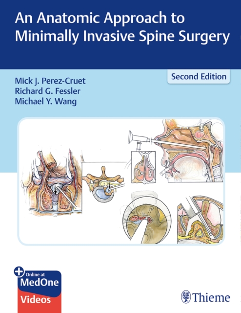 An Anatomic Approach to Minimally Invasive Spine Surgery, Mixed media product Book